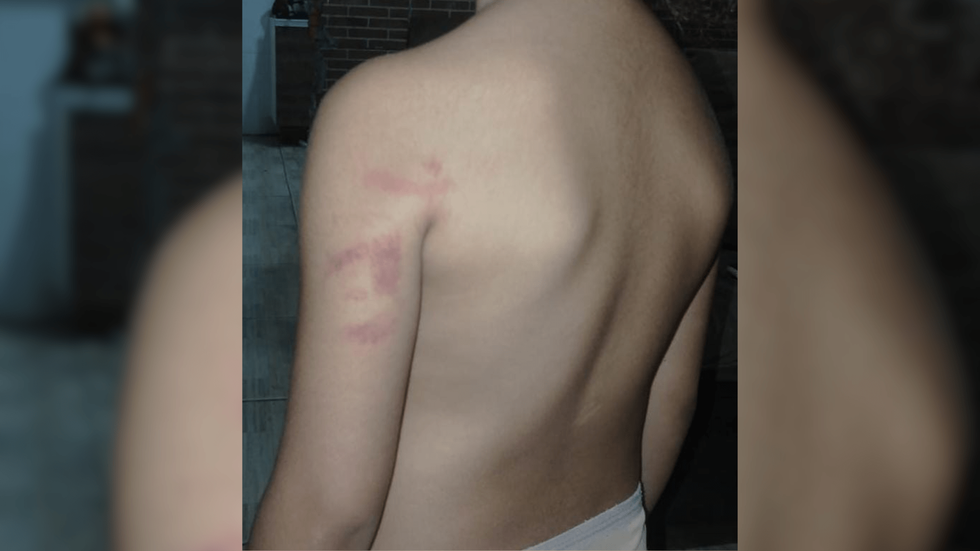 Polícia investiga caso de agressão a menina de 5 anos em escola de Mogi